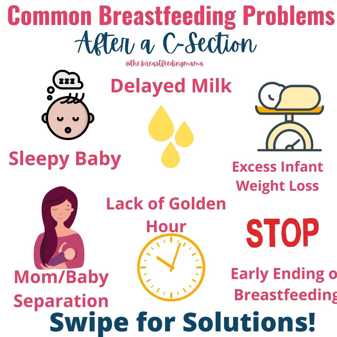 breastfeeding problems after c-section