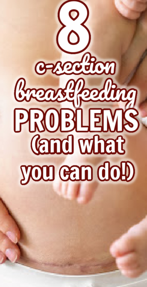 C-sections can cause problems with breastfeeding - however, most of them have solutions! Here are 7 common breastfeeding problems after a c-section along with what you can do to solve them!