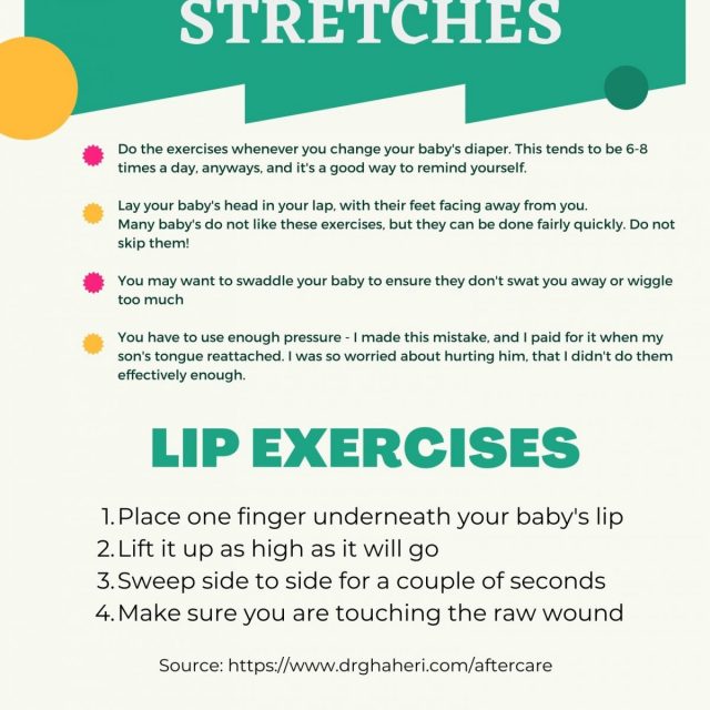 Tongue Tie Post Revision Care: Tips for Success + Printables - The ...