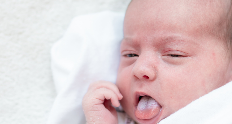 baby with thrush